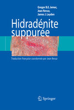 Hidradenite Suppuree