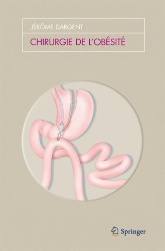 Chirurgie de L'Obesite