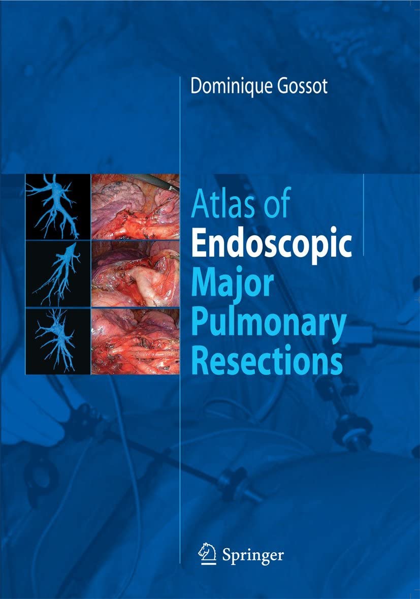 Atlas of Endoscopic Major Pulmonary Resections