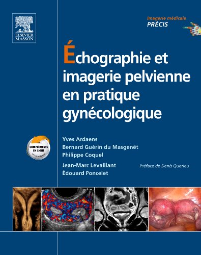 �chographie Et Imagerie Pelvienne En Pratique Gyn�cologique