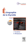 Echographie de la Thyro�de