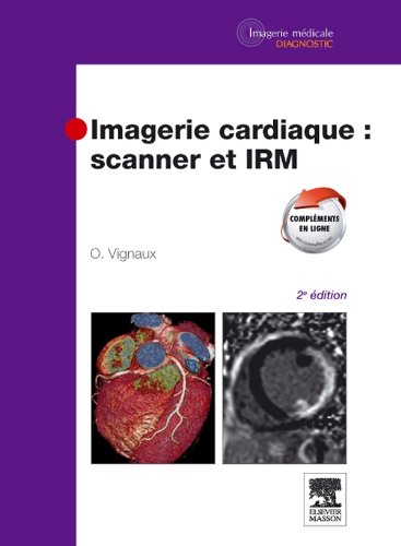 Imagerie Cardiaque