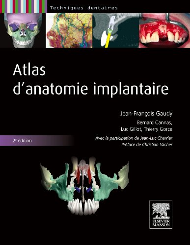 Atlas d'Anatomie Implantaire