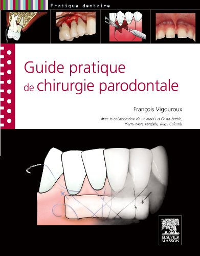 Guide Pratique de Chirurgie Parodontale