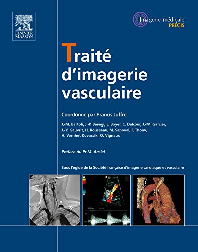 Trait� d'Imagerie Vasculaire