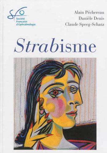 Strabismes