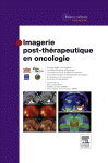 Imagerie Post-Therapeutique En Oncologie