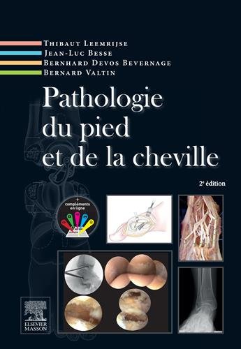 Pathologie Du Pied Et de la Cheville