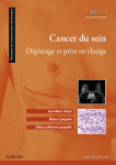 Cancer Du Sein