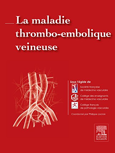 La Maladie Thrombo-Embolique Veineuse