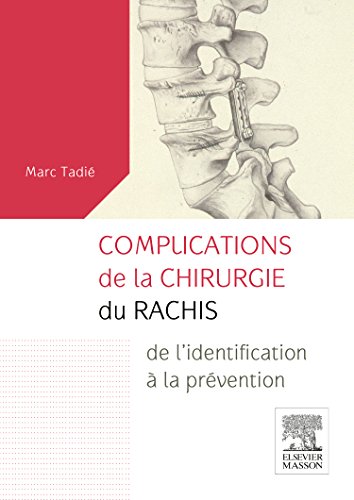 Complications de la Chirurgie Du Rachis