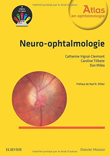 Neuro-Ophtalmologie