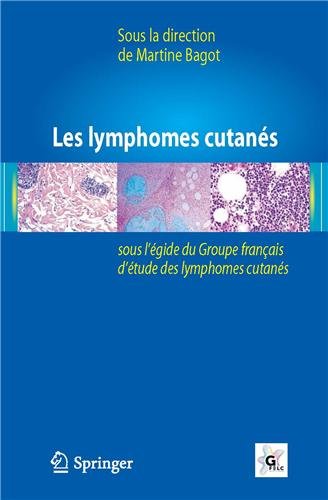 Les Lymphomes Cutan�s