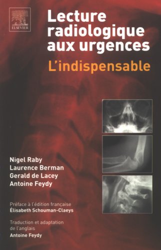 LECTURE RADIOLOGIQUE AUX URGENCES 