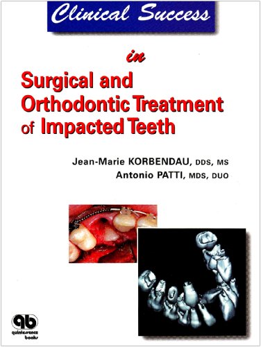 Clinical Success in Surgical And Orthodontic Treatment of Impacted Teeth