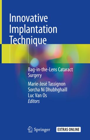 Innovative implantation technique : bag-in-the-lens cataractsurgery