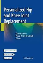 Personalized hip and knee joint replacement