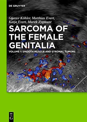 Smooth muscle and stromal tumors and prevention of inadequate surgery (Volume 1: smooth muscle and stromal tumors)