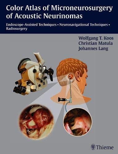 Color Atlas of Microsurgery of Acoustic Neurinomas: Endoscope-Assisted Techniques - Neuronavigational Techniques - Radiosurgery