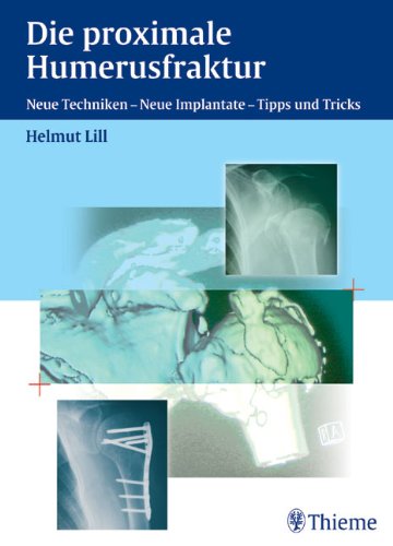 Die proximale Humerusfraktur neue Techniken - neue Implantate - Tipps und Tricks ; 26 Tabellen