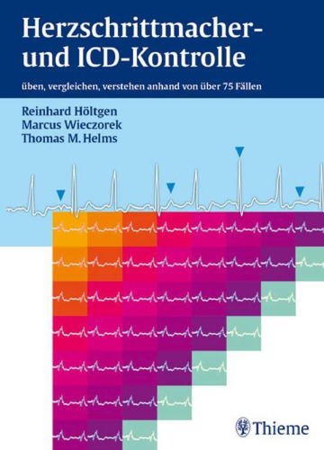 Herzschrittmacher- und ICD-Kontrolle üben, vergleichen, verstehen anhand von 76 Fällen ; 1 Tabelle