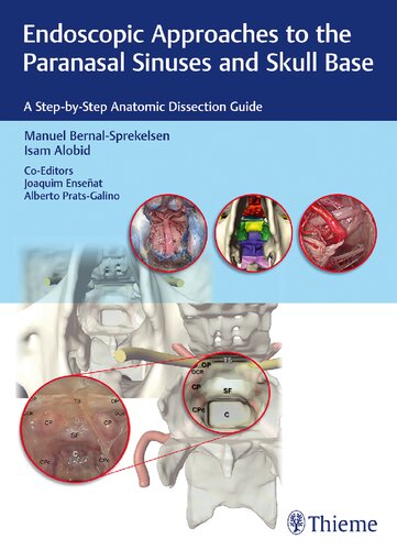Endoscopic approaches to the paranasal sinuses and skull base : a step-by-step anatomic dissection guide