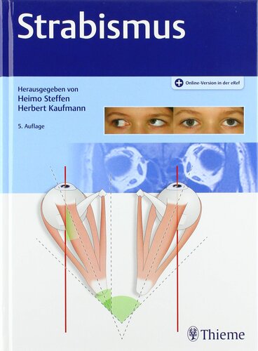 Strabismus