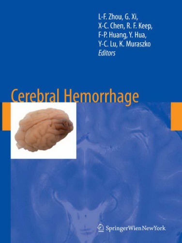 Cerebral Hemorrhage