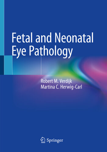 Embryology of the eye and its adnexa