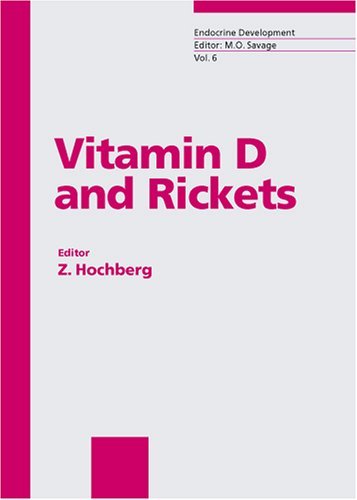 Vitamin D and Rickets
