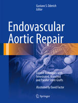 Endovascular aortic repair : current techniques with fenestrated, branched and parallel stent-grafts