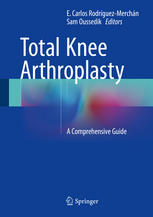 Total Knee Arthroplasty A Comprehensive Guide