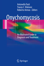 Onychomycosis An Illustrated Guide to Diagnosis and Treatment