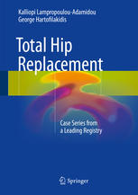 Total hip replacement : case series from a leading registry