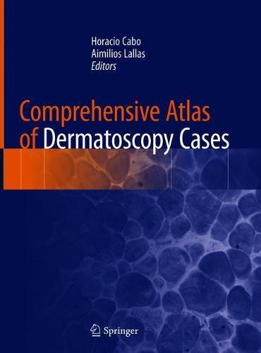 Comprehensive atlas of dermatoscopy cases