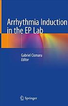 Arrhythmia induction in the EP lab