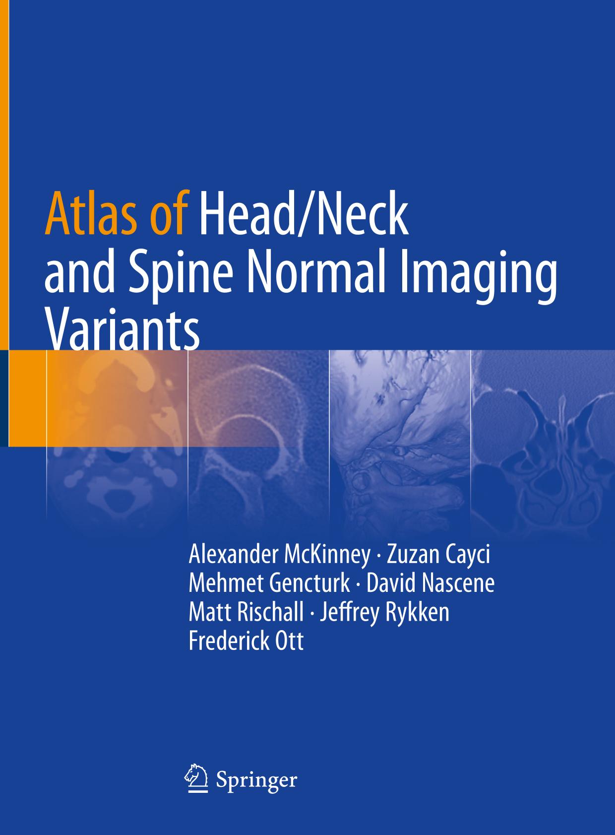 Atlas of head/neck and spine normal imaging variants