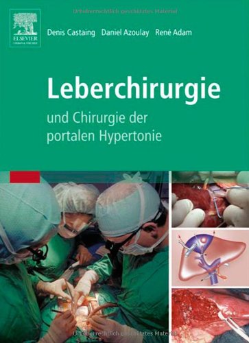 Leberchirurgie und Chirurgie der portalen Hypertonie