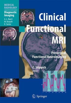 Clinical Functional MRI