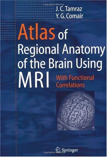 Atlas Of Regional Anatomy Of The Brain Using Mri