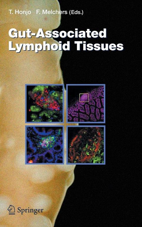Gut-Associated Lymphoid Tissues (Current Topics in Microbiology and Immunology, 308)