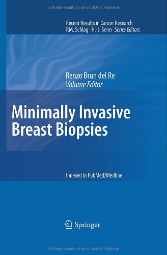 Minimally Invasive Breast Biopsies (Recent Results in Cancer Research, 173)