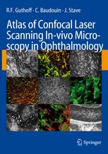 Atlas of Confocal Laser Scanning Invivo Microscopy in Ophthalmology