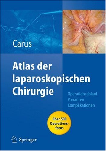 Atlas Laparoskopische Chirurgie
