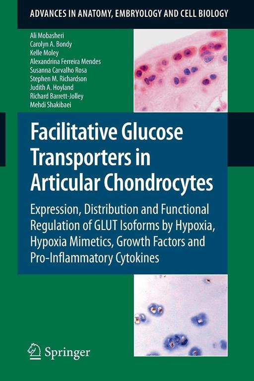 Facilitative Glucose Transporters in Articular Chondrocytes: Expression, Distribution and Functional Regulation of GLUT Isoforms by Hypoxia, Hypoxia ... in Anatomy, Embryology and Cell Biology, 200)