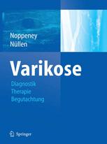 Diagnostik und Therapie der Varikose