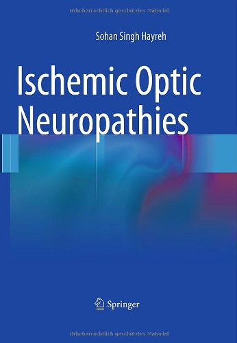 Ischemic Optic Neuropathies