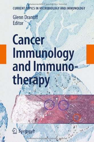 Cancer Immunology and Immunotherapy (Current Topics in Microbiology and Immunology, 344)