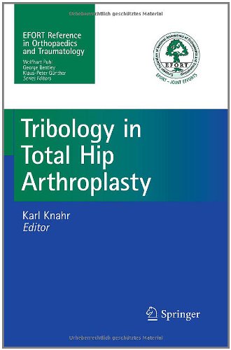 Tribology in Total Hip Arthroplasty (EFORT Reference in Orthopaedics and Traumatology)