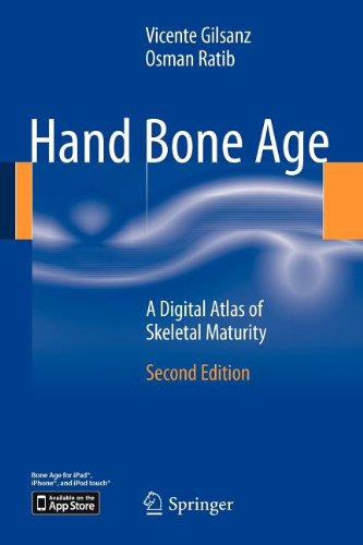 Hand Bone Age